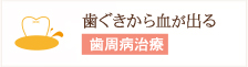 歯ぐきから血が出る 歯周病治療